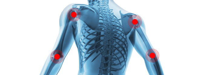 Chiropractic Colorado Springs CO Fibromyalgia Chiropractic Colorado Springs CO Fibromyalgia