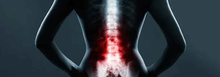 DRX9000 vs Generic Spinal Decompression Tables in Colorado Springs CO